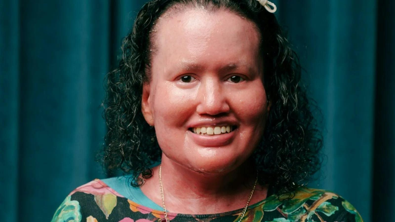 Sharing stories: Growing Up Disabled in Australia, with Carly Findlay OAM